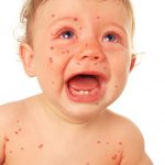 Anti-vaxxers Threaten The Herd Immunity